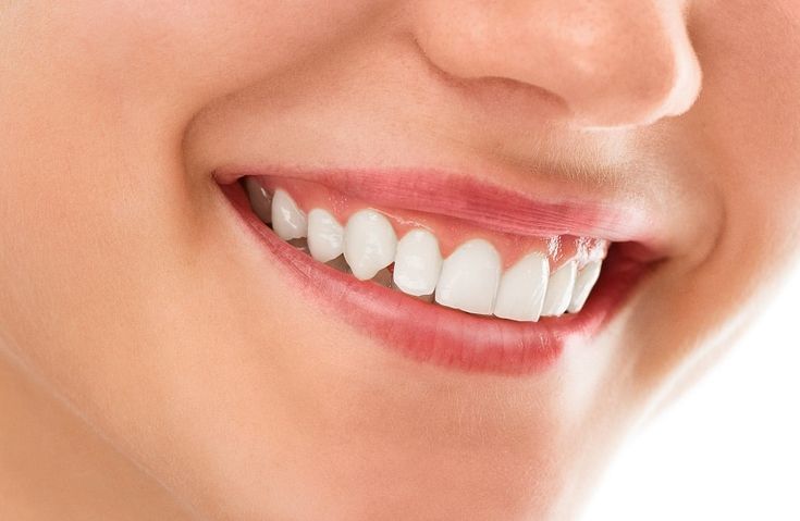 Why Healthy Teeth Matter for Everyone