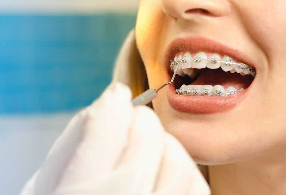 Understanding the Role of Orthodontic Care