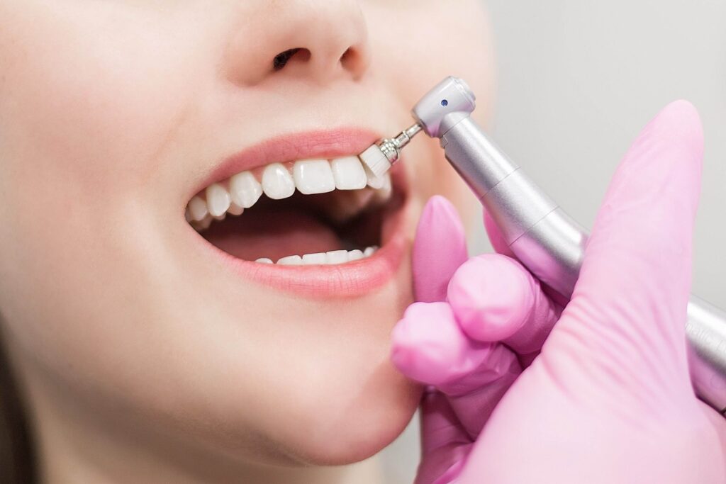The Importance of Professional Dental Advice